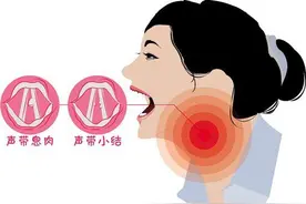 “娘娘腔”“娃娃音”也是嗓音病图片
