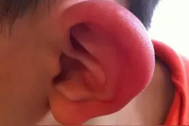 亲测驱蚊产品，原来最传统的最管用！图片