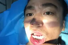 王宝强嘴角受伤缝了十针，他的校花老婆在干什么？图片