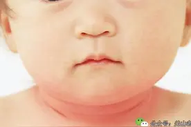 夏季你的宝宝出现痱子、淹脖子了吗？颈部护理妈妈需要知道这些图片