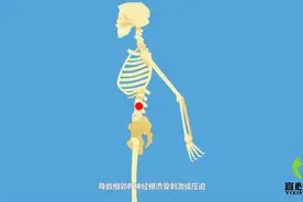 腰椎间盘突出疼痛难忍，快来试试这几招轻松解决疼痛感！视频封面