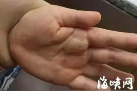 夏天，千万别让孩子摸这些地方，已有多人受伤图片