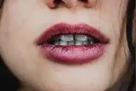莞尔一笑，贼狰狞，怎么破？图片