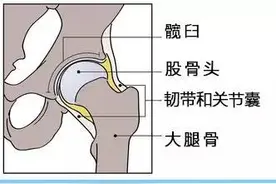 宝宝臀纹不对称，可能会影响宝宝走路，妈妈一定不能掉以轻心！图片