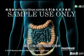 秒懂阑尾炎手术及为什么我的手术切口要比别人大？视频封面