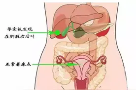 真正的心肝宝贝！女子怀孕宝宝竟然在肝脏上，罕见！图片