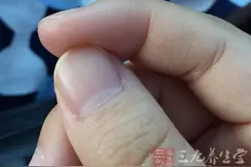 指甲上有白斑 为什么指甲上会有白斑图片