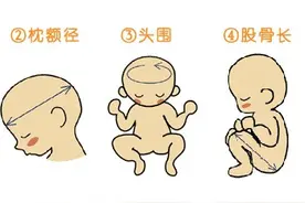 从孕检B超检查单中，看出的门道。图片