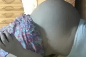 马上就要生了，大家都说是双胞胎，孕期皮肤居然都变好了图片