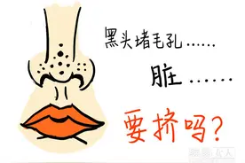 黑头不是不能挤 教你挤黑头的正确方法图片