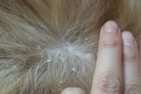 烦人的头屑来袭，柯基等狗狗身上皮屑过多应该怎样处理？图片