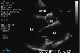 那些被误读的超声心功能测定 你看错几个？图片