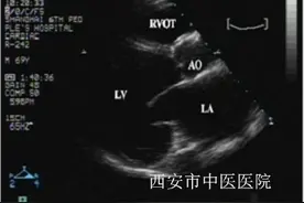 那些被误读的超声心功能测定 你看错几个？图片