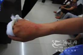 一精神病患者打人 民警身体护人致手部受伤图片