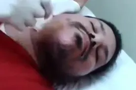 这简直就是拔猪毛神器，老外脱胡须就用它了，很酸爽视频封面