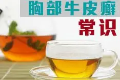 胸部牛皮癣患者能不能游泳图片