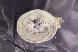 怀孕前三个月可以吃这个，生个聪明宝宝图片