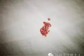 孕期准妈出现腹痛多是这几种原因，种种都很要命！图片