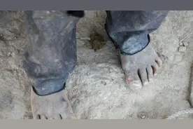 真实记录难民孩子的悲惨生活，看后你会觉得自己太幸运了图片