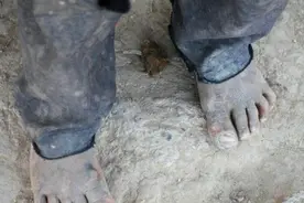 真实记录难民孩子的悲惨生活，看后你会觉得自己太幸运了图片