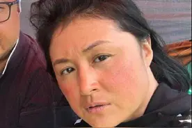 赵本山小姨子近照曝光 谢大脚一下老十岁  网友:婶这是过敏？图片