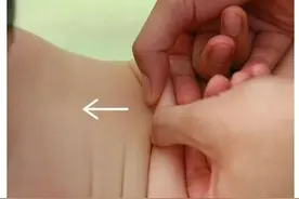 宝宝捏脊强身健体，应该这样捏（图解细节）图片