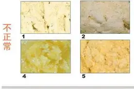 一天拉多次就是腹泻？90%的妈妈容易走入这五误区图片