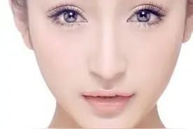 埋线双眼皮手术需要拆线吗图片
