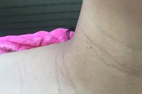 怀孕7个月，肚子，腋窝，脖子好黑像没洗澡，怀的是男宝吗？图片