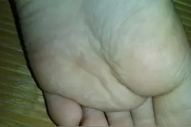 小孩脚气怎么回事？有大人的责任吗？图片