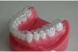 无托槽隐形矫治器 正确正畸治疗告别钢牙套图片