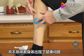 为什么有的人手上的青筋总是特别明显？这里告诉你背后原因！视频封面