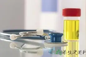 尿常规检查的正常值图片
