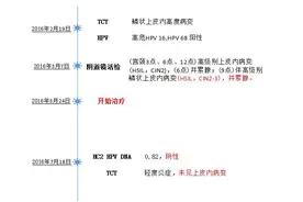 年轻的宫颈CIN患者图片