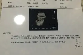孕6周就有胎心胎芽 看到B超单却让我很奇怪图片