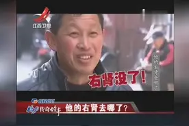 一颗缺失的右肾 一场疑点重重的手术 矛头直指医院他的肾去哪了视频封面