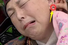韩剧里的扎针放血有科学依据吗？图片