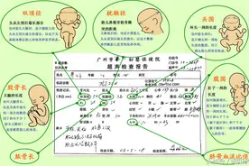 图解教孕妈妈如何看懂B超图片