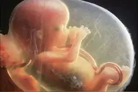 胎儿查出单脐动脉，孕妈着急，该怎么办呢？图片