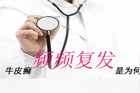 牛皮癣为何频频复发？图片