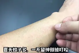 蚊子叮咬奇痒无比，一次性针筒切一刀吸一吸，1秒消肿止痒视频封面