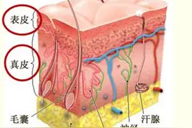 常识趴 | 这么多顽固皱纹是怎么形成的？如何去除？(上）图片