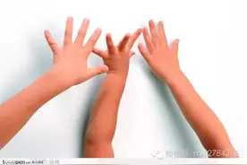 孩子拇指伸不直，很有可能得了这个病，家长真得小心了图片