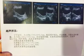 二胎双胎男宝，做B超时很戏剧，如愿儿女双全，宝妈们有接的吗？图片