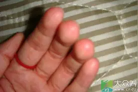 手指这么疼竟引发了全身疾病图片