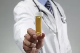 瞬间读懂尿常规化验单，你也能当医生！图片