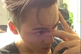 陈伟霆晒自拍居然有了抬头纹，粉丝：好想你，让我帮你抚平抬头纹图片