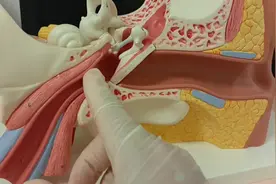 得了中耳炎必须使用滴耳剂吗？视频封面