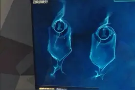 LOL游戏中，ap大嘴为什么这么厉害，这版本无敌图片