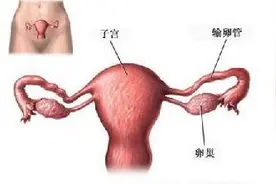 输卵管造影后男女们需要注意哪些事情？图片